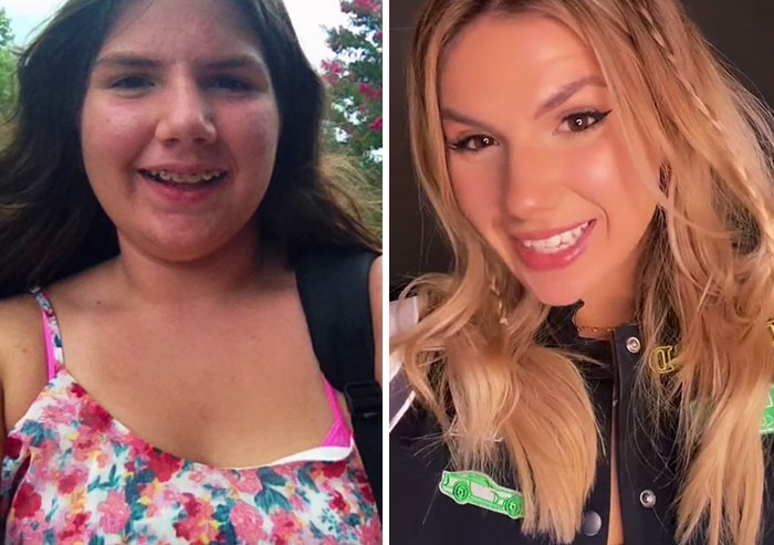 People Who Were Picked On And Bullied For Their Looks Reveal Their Jaw-Dropping Transformations People Who Were Picked On And Bullied For Their Looks Reveal Their Jaw-Dropping Transformations
