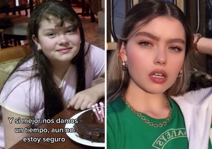 People Who Were Picked On And Bullied For Their Looks Reveal Their Jaw-Dropping Transformations People Who Were Picked On And Bullied For Their Looks Reveal Their Jaw-Dropping Transformations