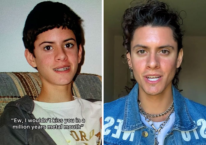 People Who Were Picked On And Bullied For Their Looks Reveal Their Jaw-Dropping Transformations People Who Were Picked On And Bullied For Their Looks Reveal Their Jaw-Dropping Transformations