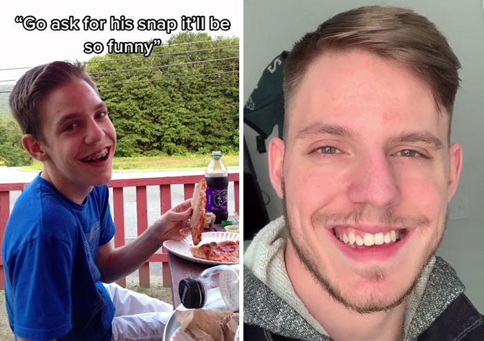 People Who Were Picked On And Bullied For Their Looks Reveal Their Jaw-Dropping Transformations People Who Were Picked On And Bullied For Their Looks Reveal Their Jaw-Dropping Transformations