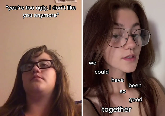 People Who Were Picked On And Bullied For Their Looks Reveal Their Jaw-Dropping Transformations People Who Were Picked On And Bullied For Their Looks Reveal Their Jaw-Dropping Transformations