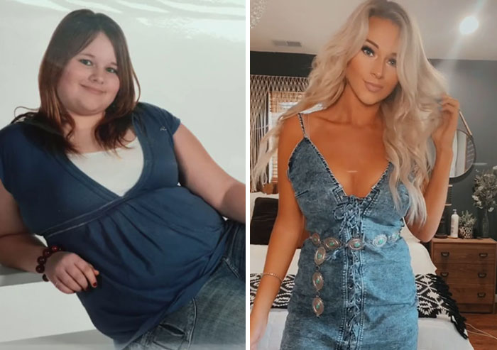 People Who Were Picked On And Bullied For Their Looks Reveal Their Jaw-Dropping Transformations People Who Were Picked On And Bullied For Their Looks Reveal Their Jaw-Dropping Transformations