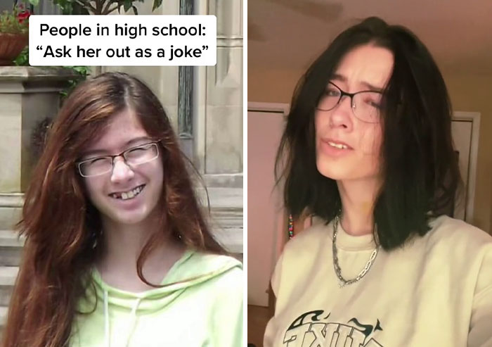 People Who Were Picked On And Bullied For Their Looks Reveal Their Jaw-Dropping Transformations People Who Were Picked On And Bullied For Their Looks Reveal Their Jaw-Dropping Transformations