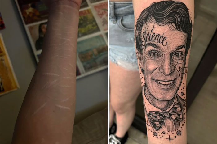 30 Before & After Pics Of Terrible Tattoos Getting Fixed, As Shared In This Online Group 30 Before & After Pics Of Terrible Tattoos Getting Fixed, As Shared In This Online Group