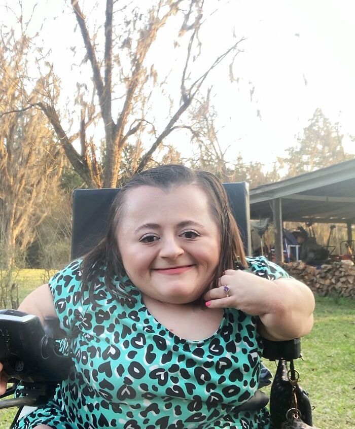 This Resilient Woman Became A Beauty Influencer Despite Her Disability This Resilient Woman Became A Beauty Influencer Despite Her Disability