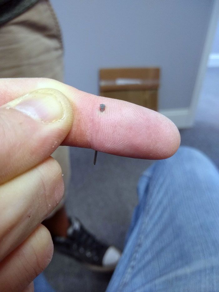 50 Painfully Uncomfortable Pics No One Asked For Ever