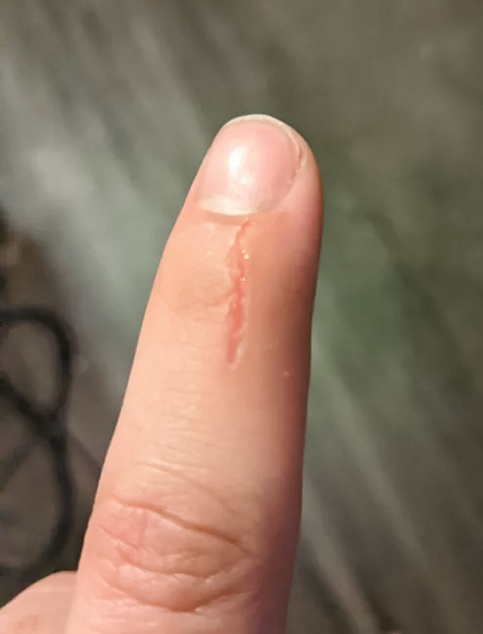 50 Painfully Uncomfortable Pics No One Asked For Ever