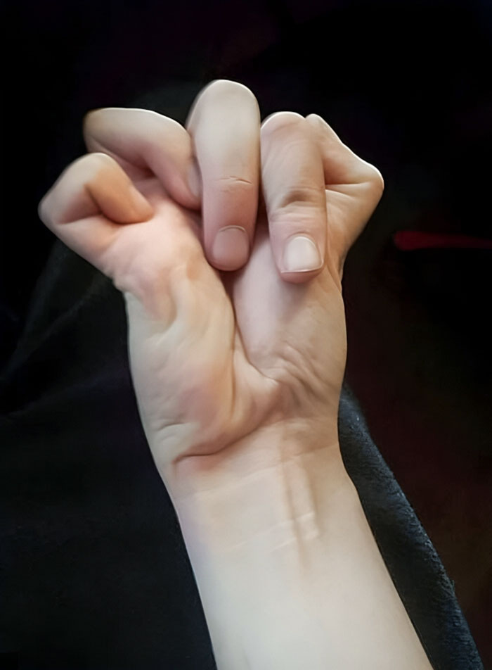 50 Painfully Uncomfortable Pics No One Asked For Ever