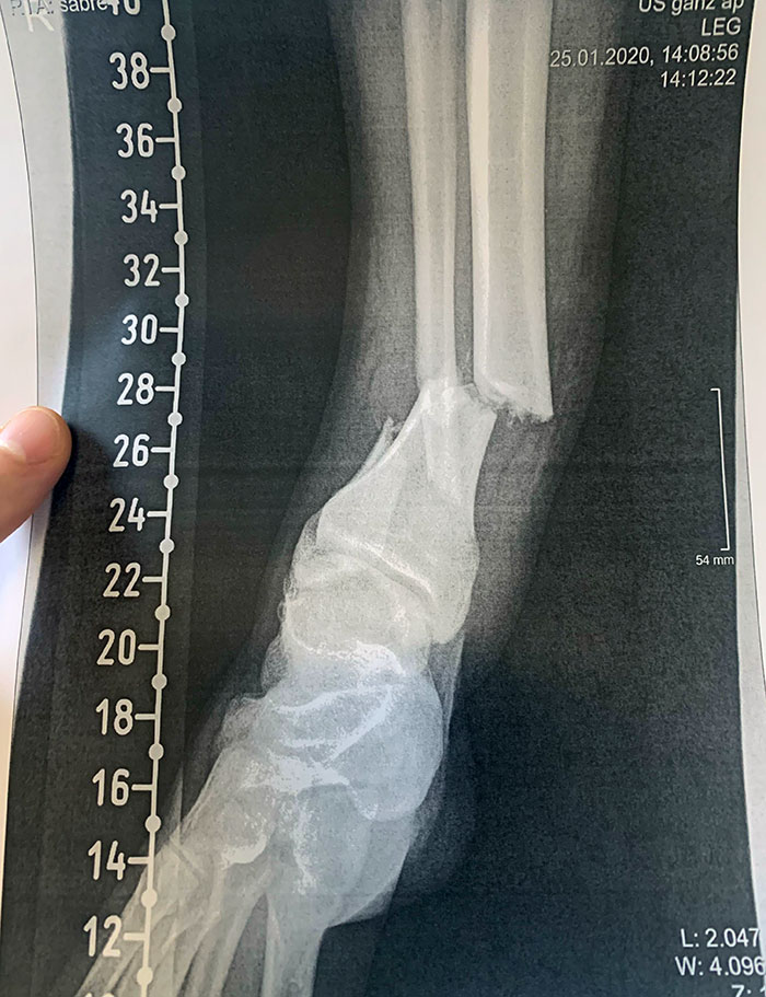 50 Painfully Uncomfortable Pics No One Asked For Ever