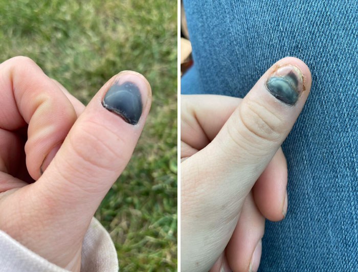 50 Painfully Uncomfortable Pics No One Asked For Ever