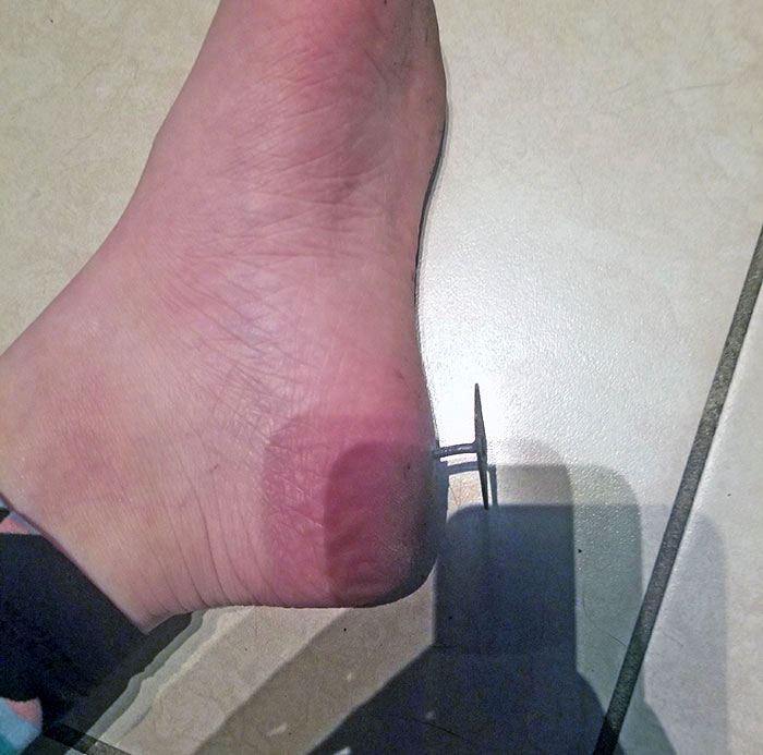 50 Painfully Uncomfortable Pics No One Asked For Ever