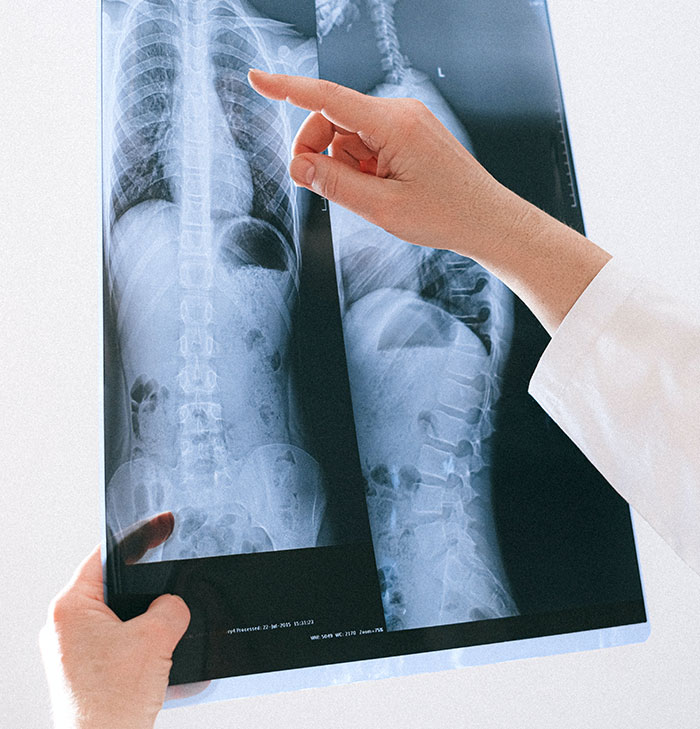 “What Is The Stupidest Reason You Went To Hospital?” (35 Answers) “What Is The Stupidest Reason You Went To Hospital?” (35 Answers)