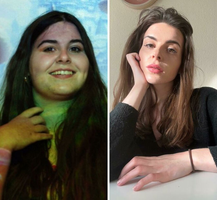 50 Times People Surprised Everyone By Losing So Much Weight They Looked Like A Different Person (New Pics) 50 Times People Surprised Everyone By Losing So Much Weight They Looked Like A Different Person (New Pics)