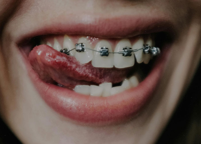 30 People Share Flexes They’re Proud Of But Too Embarrassed To Show Off