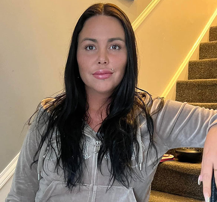 33-Year-Old Mom Of Five Is UK’s First Person To Lose Life In UK From Undergoing BBL 33-Year-Old Mom Of Five Is UK’s First Person To Lose Life In UK From Undergoing BBL
