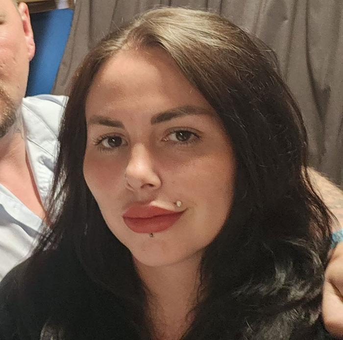 33-Year-Old Mom Of Five Is UK’s First Person To Lose Life In UK From Undergoing BBL 33-Year-Old Mom Of Five Is UK’s First Person To Lose Life In UK From Undergoing BBL