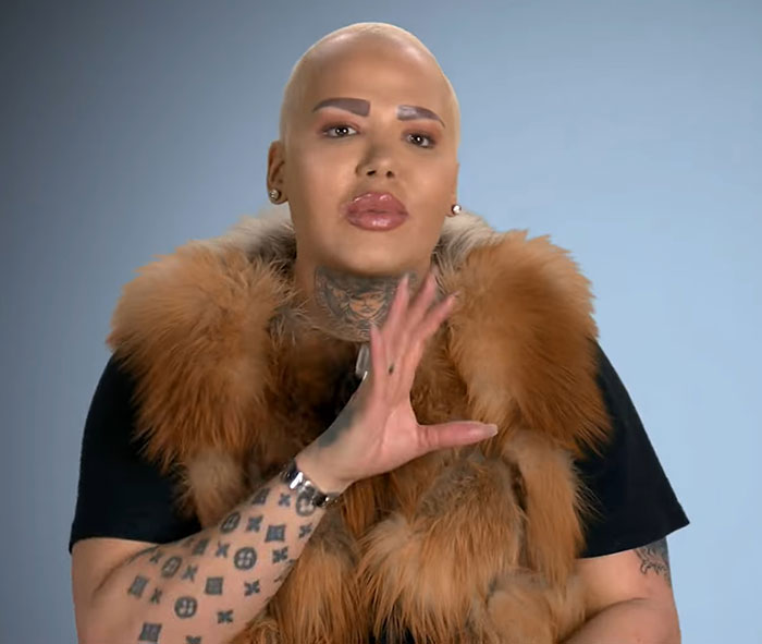 33-Year-Old Mom Of Five Is UK’s First Person To Lose Life In UK From Undergoing BBL 33-Year-Old Mom Of Five Is UK’s First Person To Lose Life In UK From Undergoing BBL