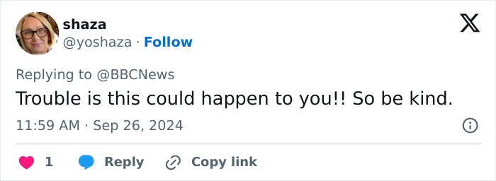 “Scaring The Customers”: Man Says Restaurant Threw Him Out Because Of His Facial Disfigurement “Scaring The Customers”: Man Says Restaurant Threw Him Out Because Of His Facial Disfigurement