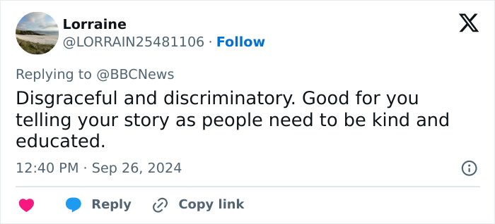 “Scaring The Customers”: Man Says Restaurant Threw Him Out Because Of His Facial Disfigurement “Scaring The Customers”: Man Says Restaurant Threw Him Out Because Of His Facial Disfigurement