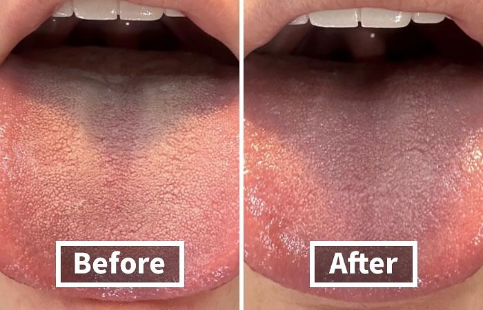 You’re Not Alone: 22 Relatable Body Problems (And How To Fix Them) You’re Not Alone: 22 Relatable Body Problems (And How To Fix Them)