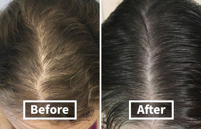 You’re Not Alone: 22 Relatable Body Problems (And How To Fix Them) You’re Not Alone: 22 Relatable Body Problems (And How To Fix Them)