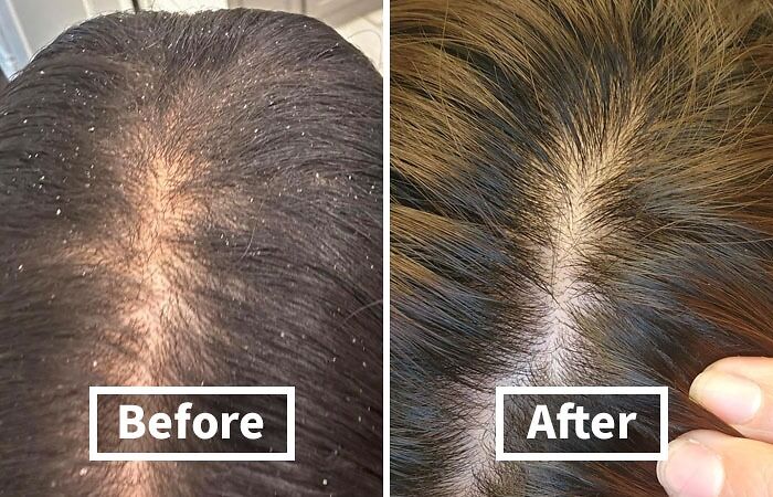 You’re Not Alone: 22 Relatable Body Problems (And How To Fix Them) You’re Not Alone: 22 Relatable Body Problems (And How To Fix Them)