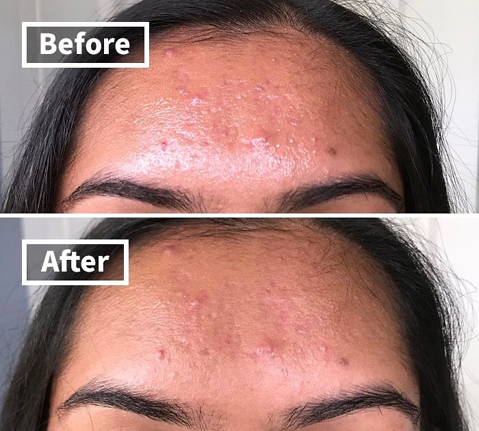 You’re Not Alone: 22 Relatable Body Problems (And How To Fix Them) You’re Not Alone: 22 Relatable Body Problems (And How To Fix Them)