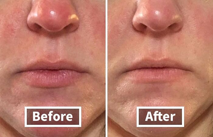 You’re Not Alone: 22 Relatable Body Problems (And How To Fix Them) You’re Not Alone: 22 Relatable Body Problems (And How To Fix Them)