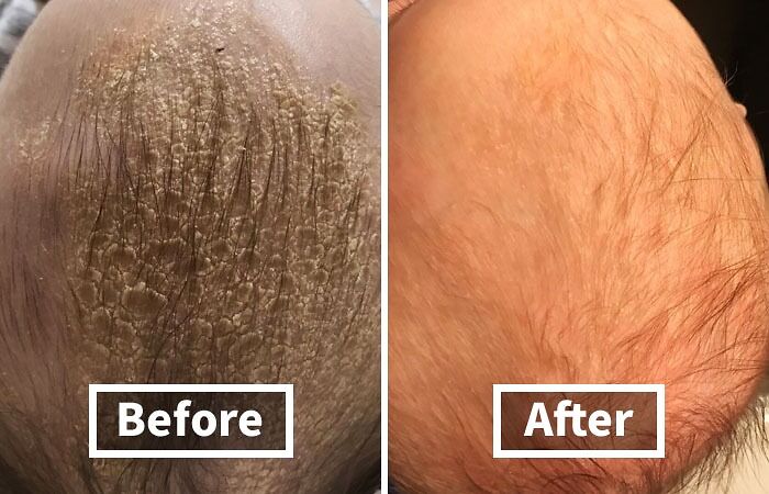 You’re Not Alone: 22 Relatable Body Problems (And How To Fix Them) You’re Not Alone: 22 Relatable Body Problems (And How To Fix Them)