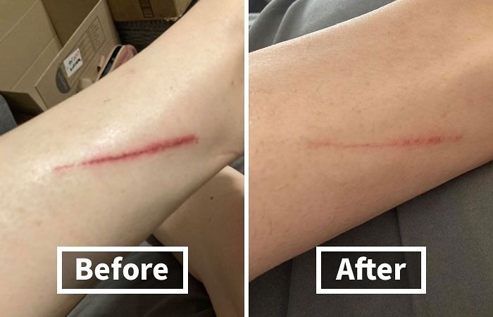 You’re Not Alone: 22 Relatable Body Problems (And How To Fix Them) You’re Not Alone: 22 Relatable Body Problems (And How To Fix Them)