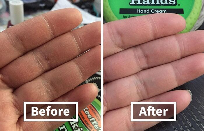 You’re Not Alone: 22 Relatable Body Problems (And How To Fix Them) You’re Not Alone: 22 Relatable Body Problems (And How To Fix Them)