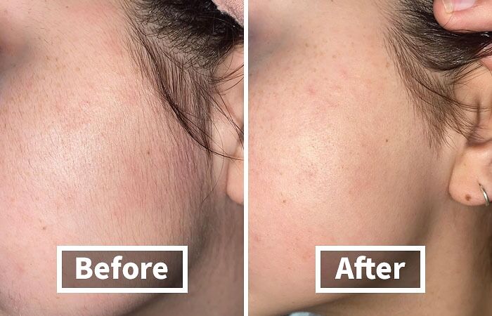 21 Items That Saw A Problem And Said: “Consider It Solved” 21 Items That Saw A Problem And Said: “Consider It Solved”