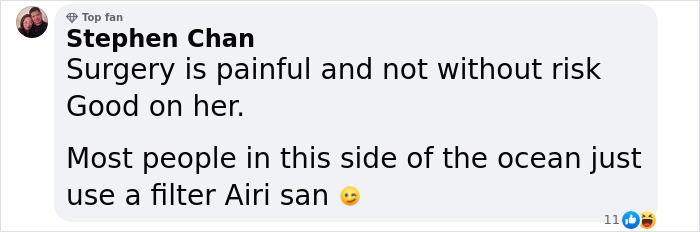 “Finally Beautiful”: Japanese Model Becomes Unrecognizable After 20+ Plastic Surgeries “Finally Beautiful”: Japanese Model Becomes Unrecognizable After 20+ Plastic Surgeries