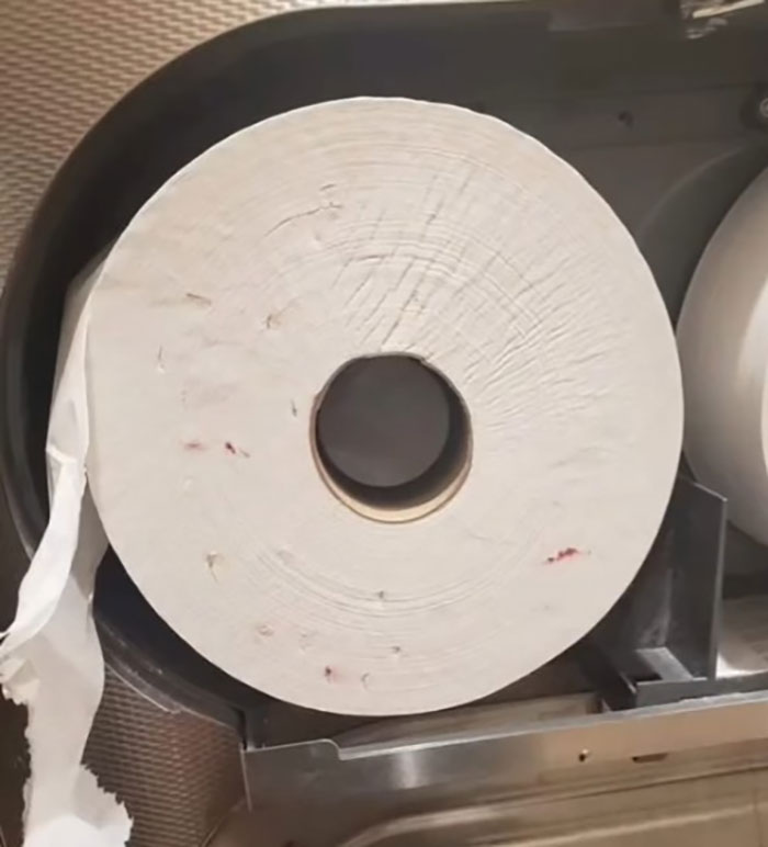 Viral Pic Of Bloody Toilet Paper Soiled By Drug Users Sparks HIV Misinformation, Doctor Reacts Viral Pic Of Bloody Toilet Paper Soiled By Drug Users Sparks HIV Misinformation, Doctor Reacts