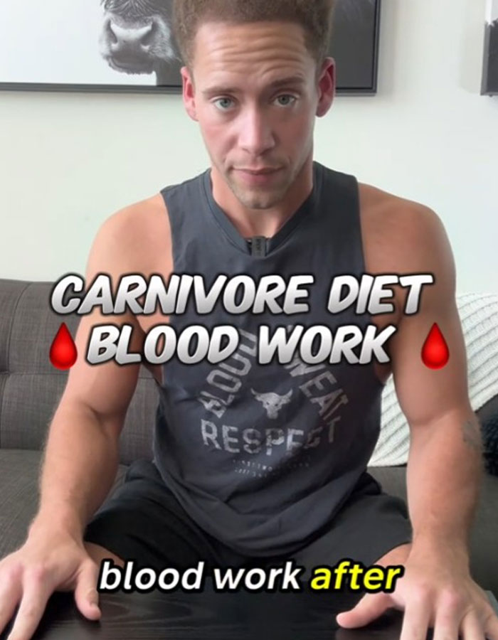 “So Everybody Was Right”: Man Gets Mixed Reactions After Sharing Results Of Carnivore Diet “So Everybody Was Right”: Man Gets Mixed Reactions After Sharing Results Of Carnivore Diet