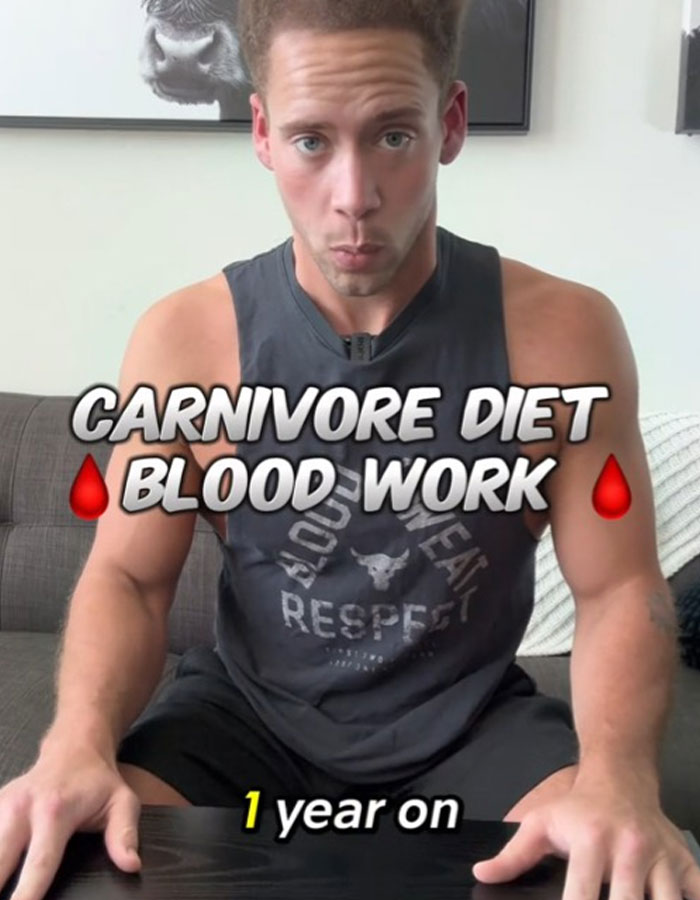 “So Everybody Was Right”: Man Gets Mixed Reactions After Sharing Results Of Carnivore Diet “So Everybody Was Right”: Man Gets Mixed Reactions After Sharing Results Of Carnivore Diet