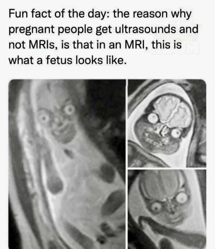 50 Posts From This FB Page Dedicated To “Amazing Facts And Unbelievable Things In The World” (New Pics) 50 Posts From This FB Page Dedicated To “Amazing Facts And Unbelievable Things In The World” (New Pics)