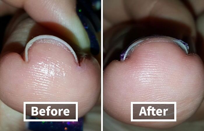 We Don’t Know If We Should Laugh Or Cringe At The 21 Unluckiest People On Reddit We Don’t Know If We Should Laugh Or Cringe At The 21 Unluckiest People On Reddit