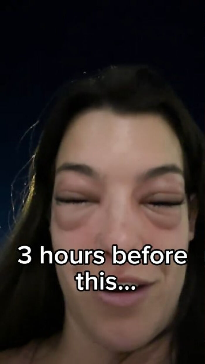 “Crazy”: Woman Ends Up In The ER With Swollen Face After Visiting Pickle-Themed Food Festival “Crazy”: Woman Ends Up In The ER With Swollen Face After Visiting Pickle-Themed Food Festival