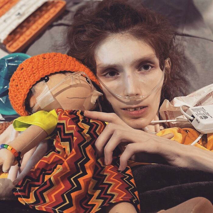 Woman Creates Dolls That Fit Each Child’s Needs While Representing Their Rare Health Conditions (26 New Pics)