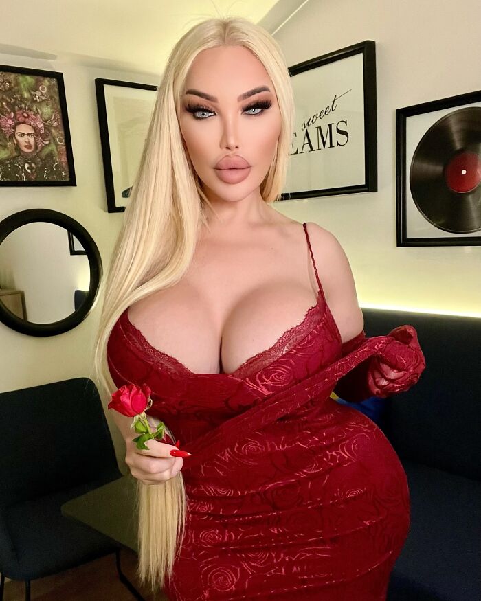 Jessica Alves Covered In Bandages After Fifth Facelift: &ldquo;3 Or 4 Inches [Of Skin] Would Come Off&rdquo;