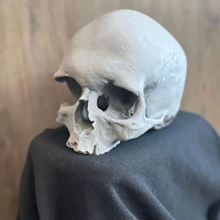 DNA Analysis Solves Mystery Of Human Skull Found During Home Renovations: “Grave Robbing” DNA Analysis Solves Mystery Of Human Skull Found During Home Renovations: “Grave Robbing”
