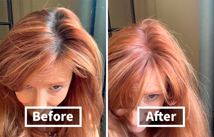 We&#8217;re Not Blushing Anymore: 18 Fixes For Those Embarrassing Body Probs