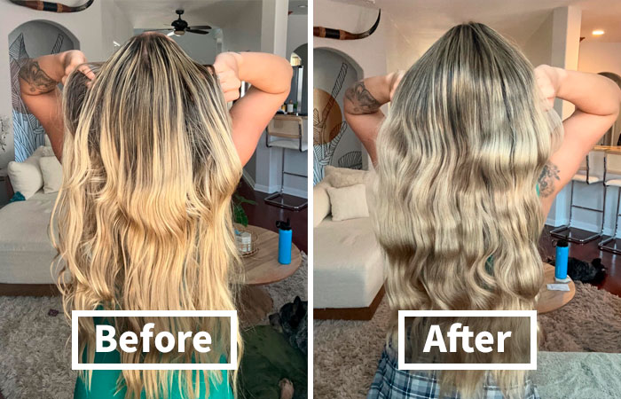 We&#8217;re Not Blushing Anymore: 18 Fixes For Those Embarrassing Body Probs