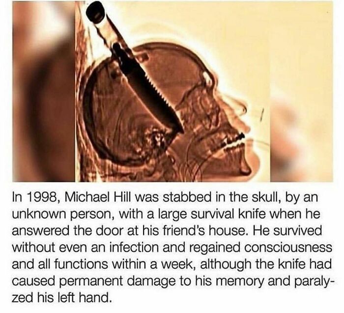 40 Horror Stories And Facts That Might Give You Goosebumps, As Shared On This IG Account 40 Horror Stories And Facts That Might Give You Goosebumps, As Shared On This IG Account