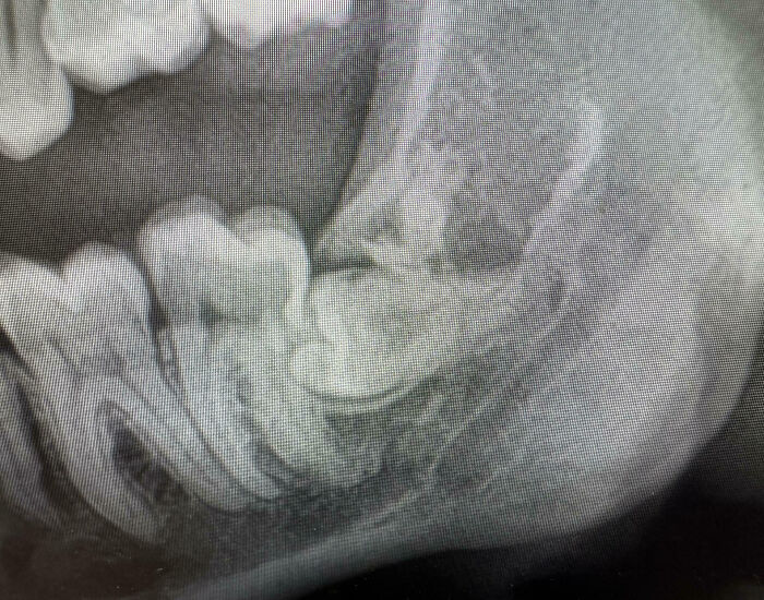 If You Think You&rsquo;re Having A Terrible Day, These People Beg To Differ (New Pics)