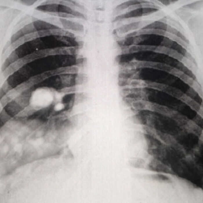 If You Think You&rsquo;re Having A Terrible Day, These People Beg To Differ (New Pics)