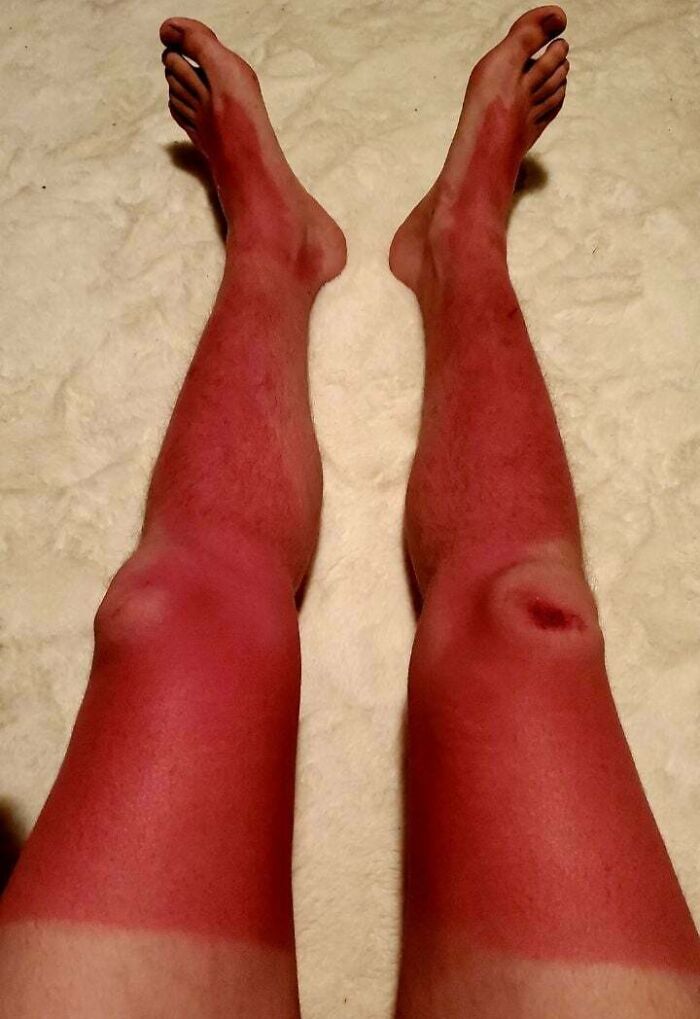 If You Think You&rsquo;re Having A Terrible Day, These People Beg To Differ (New Pics)