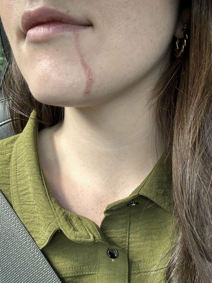 If You Think You&rsquo;re Having A Terrible Day, These People Beg To Differ (New Pics)