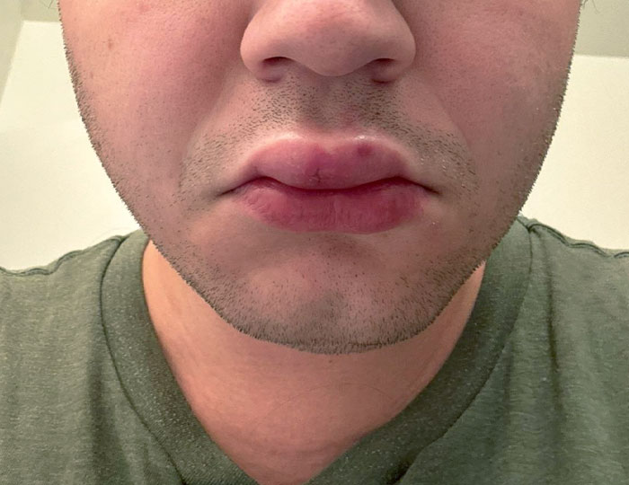 If You Think You&rsquo;re Having A Terrible Day, These People Beg To Differ (New Pics)